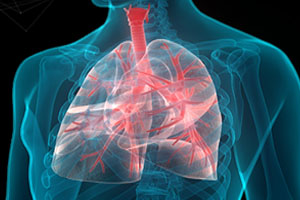 Asthma Image